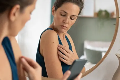 Mulher observando uma pinta no braço diante do espelho